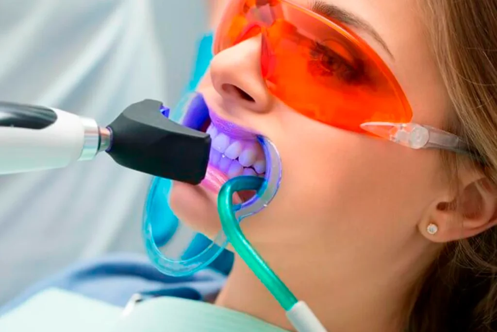 clareamento dental analia franco
